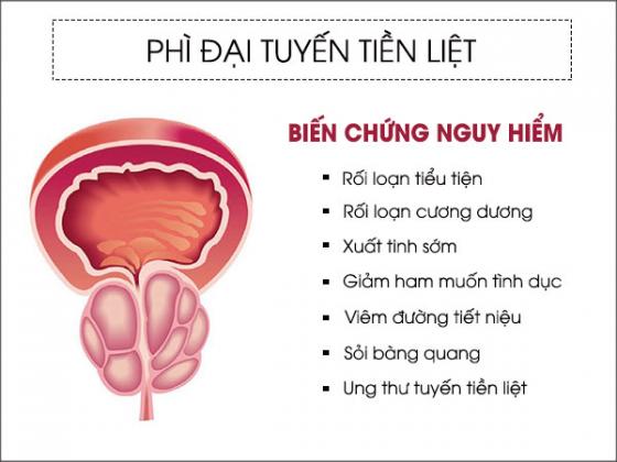 bien-chung-phi-dai-tuyen-tien-liet.jpg