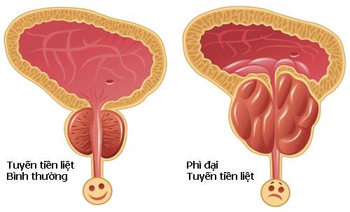 5dbcf3b98c4d8121f6e5cabb_phi-dai-tuyen-tien-liet.jpg