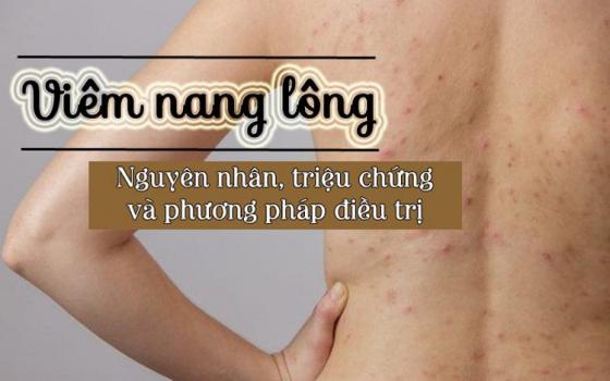 viem-nang-long-nguyen-nhan-trieu-chung-chan-doan-va-dieu-tri.jpg