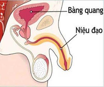 Hẹp niệu đạo có thể gây vô sinh | Vinmec